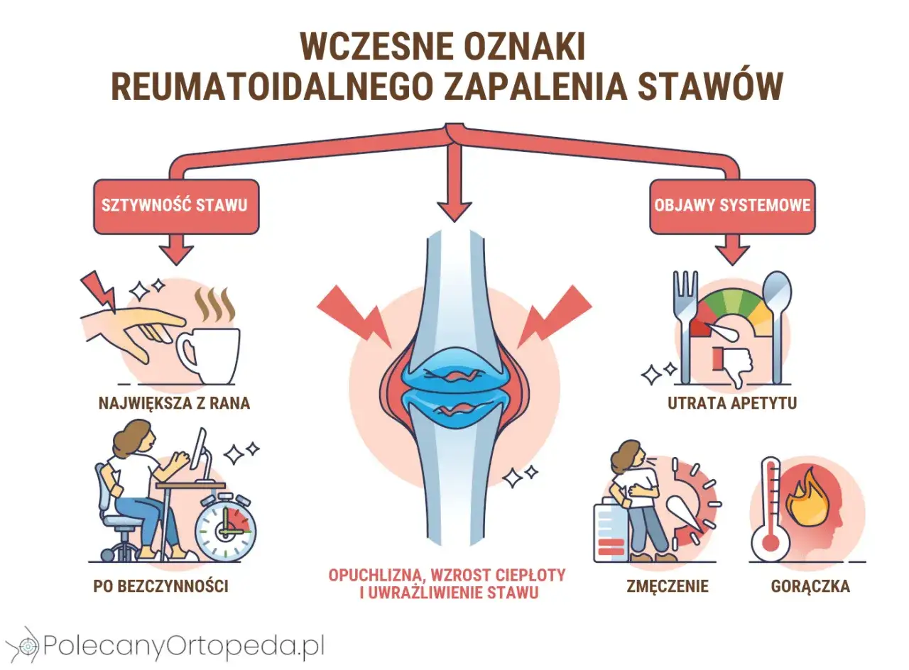 Wczesne oznaki RZS: sztywność stawu (np. trudność z chwytaniem kubka), opuchlizna, utrata apetytu, zmęczenie, gorączka.